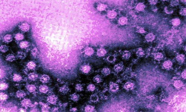 enterovirus