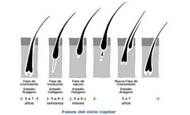fotodepilación médica