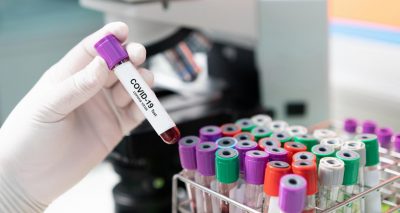 coronavirus