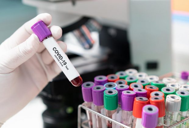 coronavirus