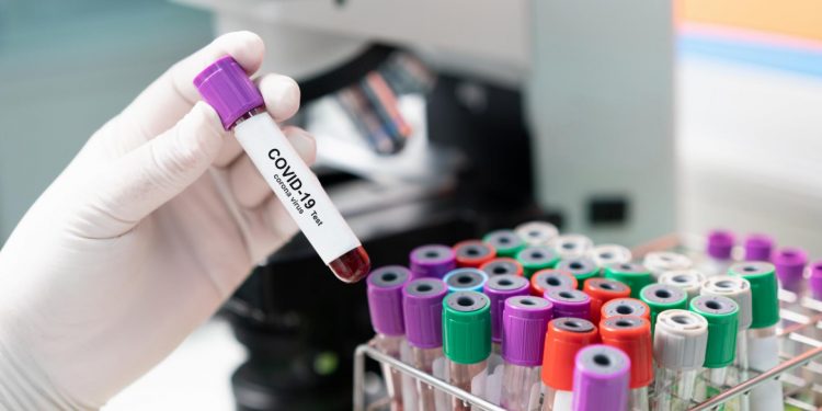 coronavirus